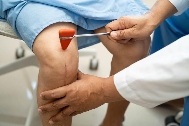 Knee Replacement Surgery in Delhi: What to Expect Before and After